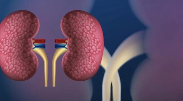 actualitati in transplantul renal cu prof dr adrian covic la academia de sanatate