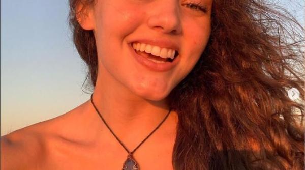 modelul claire bridges in varsta de 21 de ani si a pierdut picioarele din cauza complicatiilor cauzate de covid 19