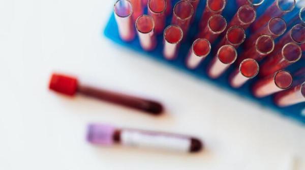 analizele anuale obligatorii pe care ar trebui sa le facem boanta trebuie sa ajutam pacientul