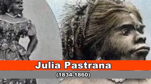 incredibila poveste a femeii maimuta julia pastrana care a primit 20 de cereri in casatorie