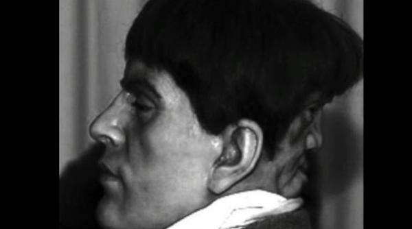 edward mordrake povestea barbatului cu doua fete