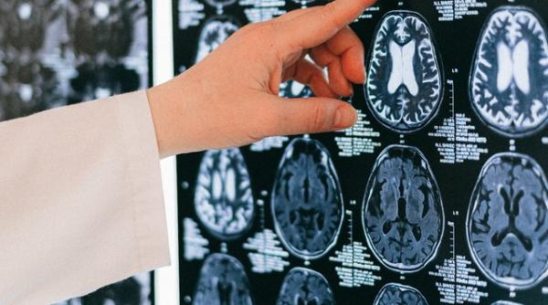 cel mai tulburator lucru cand esti in fata cu viata prof miron bogdan boala este un atac suferinta la fel de misterioasa ca viata