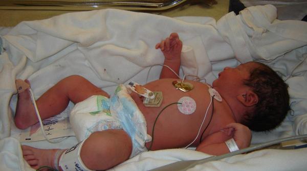 virusul misterios care afecteaza grav copiii a ajuns si in romania oms bilant alarmant adenovirusul este o ipoteza posibila