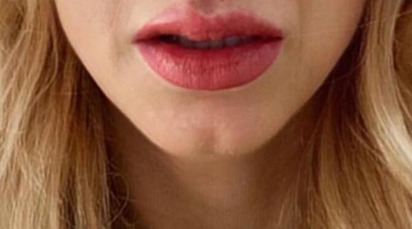 andreea balan accident grav artista a ajuns pe mana medicilor care i au cusut buza