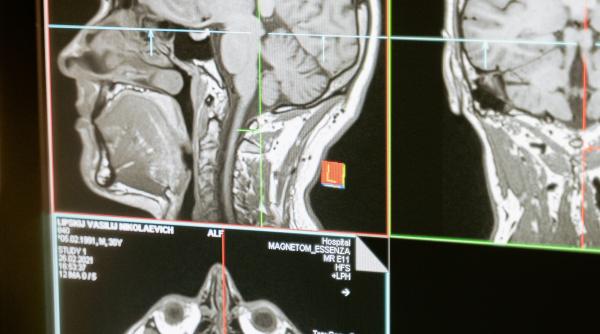 18 alimente care te ajuta impotriva radiatiilor le gasesti in toate magazinele
