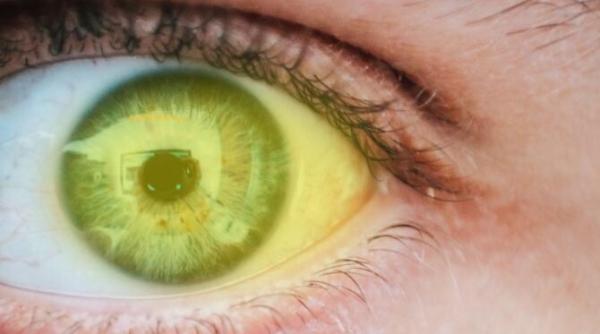 ochi galbeni ce afectiuni grave semnaleaza simptomul