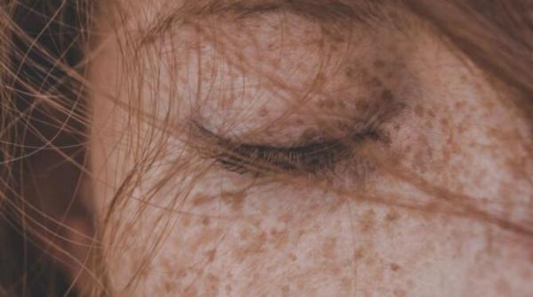 pistrui falsi o tendinta periculoasa pe tiktok dermatologii trag un semnal de alarma nu incercati asta