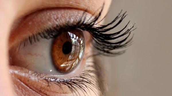 ai vinisoare rosii pe albul ochilor care sunt cauzele acestora si cum pot fi tratate