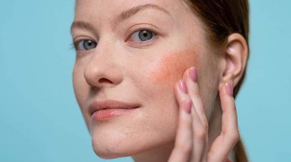 ce sa consumi pentru a ti proteja pielea in timpul verii