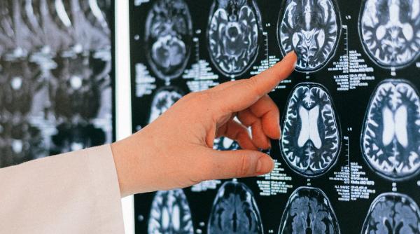 anorexia poate duce la schimbari majore in structura creierului