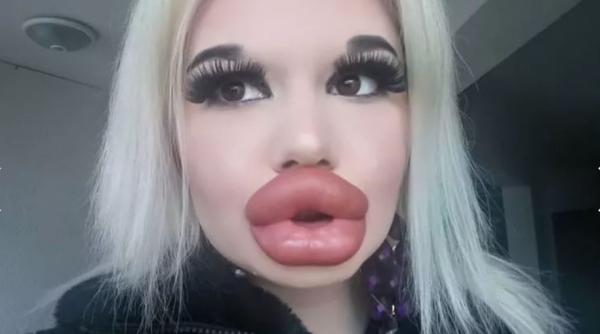 are cele mai mari buze din lume tanara din bulgaria a facut pana acum 15 operatii estetice vezi foto