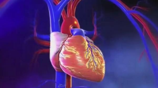 prof dr univ cristina tiu cum poate fi scazut riscul de avc prin tratamentul corect al fibrilatiei atriale