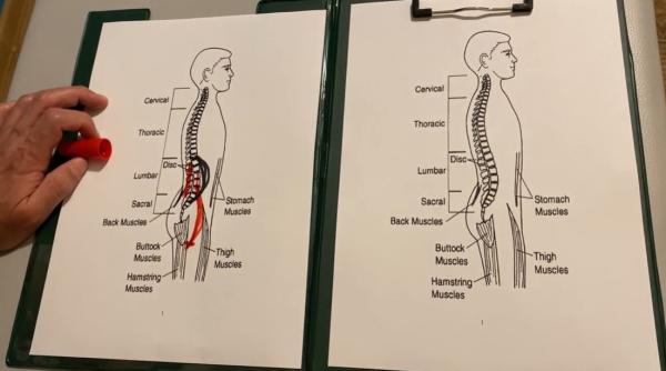 lordoza la copii ce este si cand trebuie sa se intervina