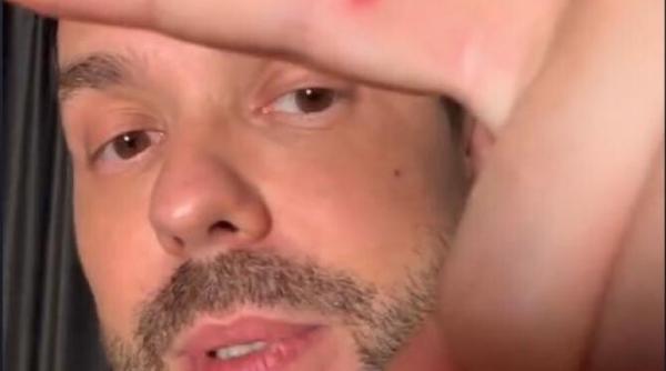 un blogger si designer de moda a fost testat pozitiv pentru variola maimutei