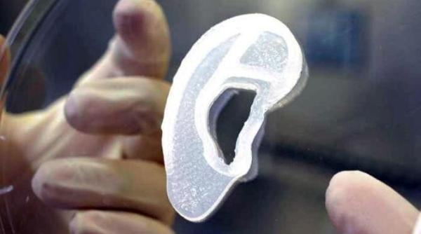 s a facut primul transplant de ureche imprimata 3d are in compozitie celulele pacientului
