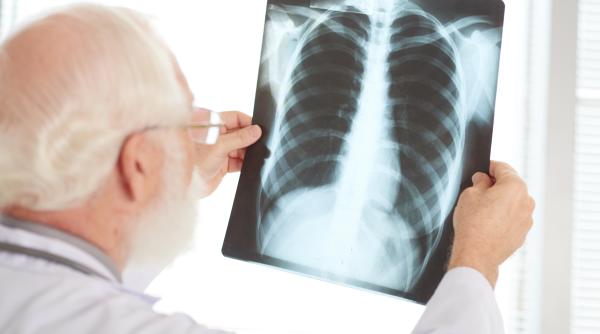 la fiecare ora un roman moare din cauza acestei boli