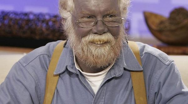 povestea lui papa strumf singurul om cu pielea albastra din lume nu s a nascut asa