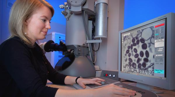 al doilea caz de variola maimutei a fost confirmat in republica moldova