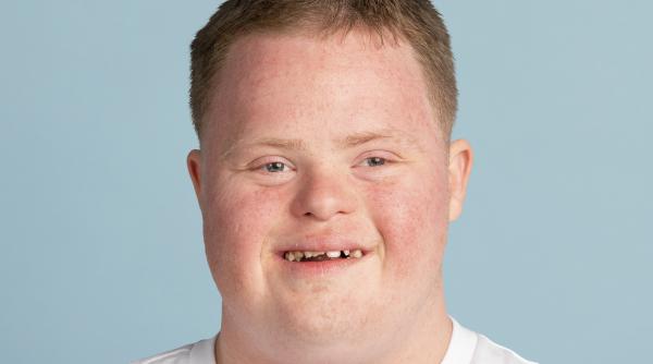 tratament revolutionar pentru sindromul down