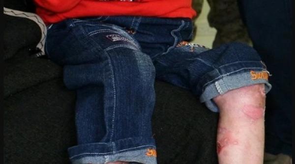 blestemul copiilor fluture ce se ascunde in spatele bolii care ii fragilizeaza