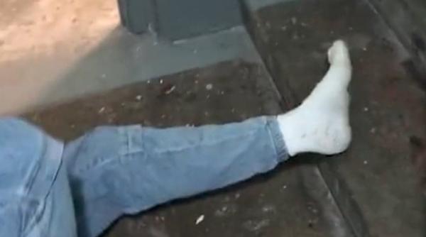 metoda folosita de un tanar rus pentru a si rupe piciorul urla de durere dar si a dorit cu orice pret sa scape de mobilizare video