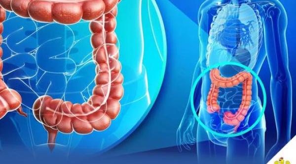 in ilfov continua programul de preventie depistare precoce diagnostic si tratament precoce al leziunilor precanceroase colorectale