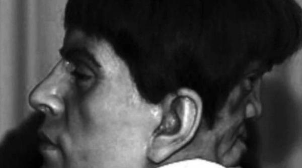 povestea lui edward mordrake omul cu doua fete