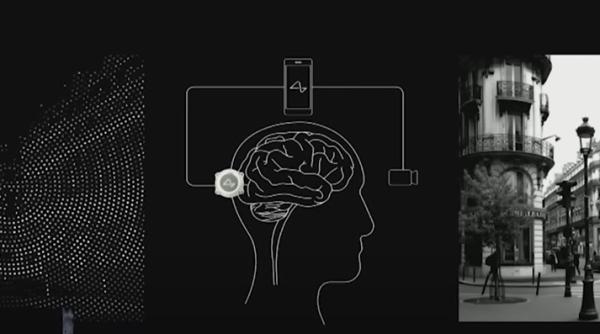 neuralink musk spera sa implanteze primul microcip in creierul uman in maximum sase luni