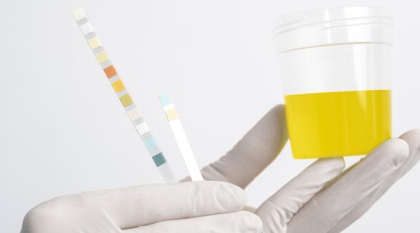 boala fara nume vezica urinara a unei femei produce alcool