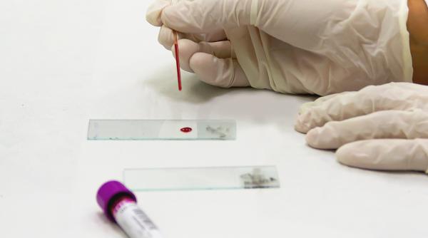 test de sange pentru diagnosticarea bolii alzheimer rezultat in 15 minute de unde va putea fi cumparat kitul de diagnosticare