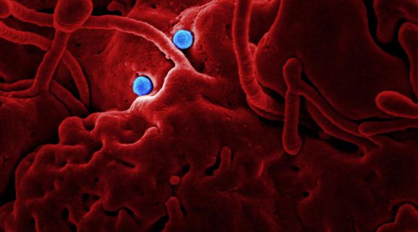 premiera mondiala a fost descoperit un organism care poate manca exclusiv virusi