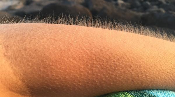 ce ti face pielea de gaina