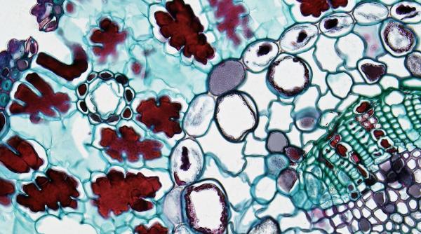 alerta la braila o bacterie periculoasa a fost descoperita in dunare