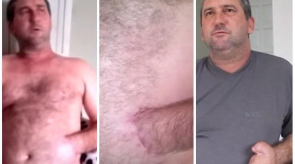 i au cusut mana in stomac explicatia medicului care l a operat