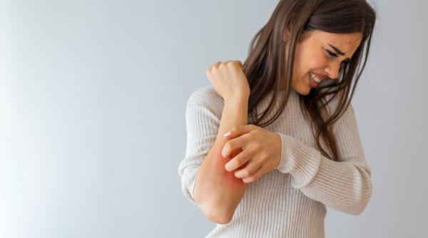 ce este dermatita si ce tipuri exista