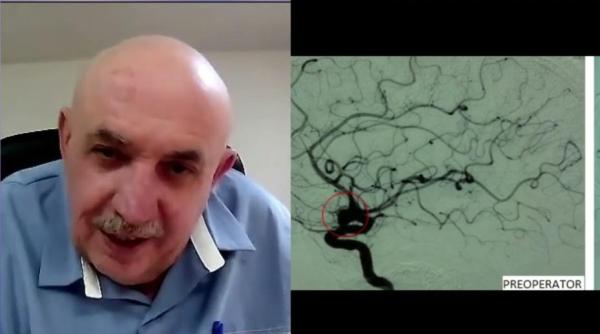 chirurgia bolilor vasculare cerebrale dr corneliu toader la academia de sanatate