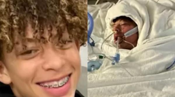 o provocare pe tiktok l a desfigurat un baiat s a ales cu arsuri pe 80prc din corp dupa ce a incercat sa si impresioneze prietenii cu un truc