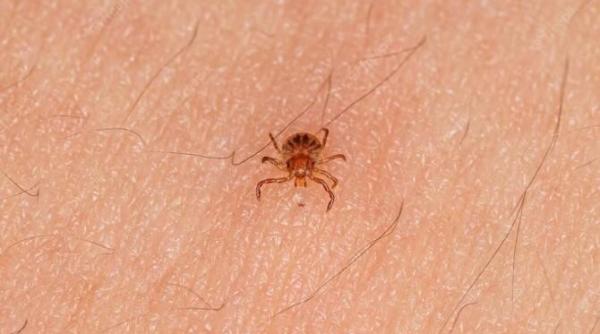 mergi la plimbare pune in geanta acest produs si capusele te vor evita