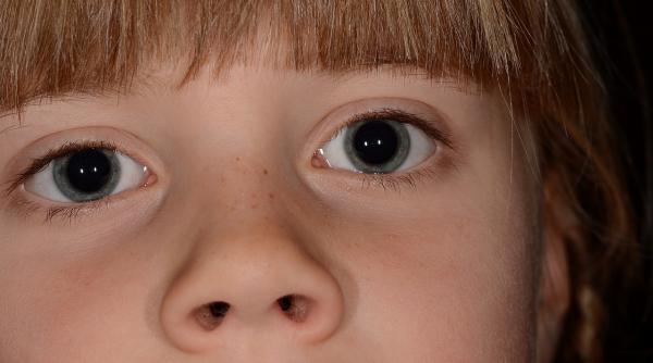 sinuzita acuta la copii dr mihai craiu mesaj de luat acasa in mod sigur nu au toti nevoie de antibiotic