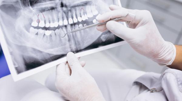 un medicament minune ne va face dintii sa creasca din nou ca cei de lapte cand va intra pe piata