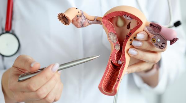 brahiterapia in tratamentul cancerului genital bogdan tratamentul in cancerul de col uterin local avansat este un tratament multimodal