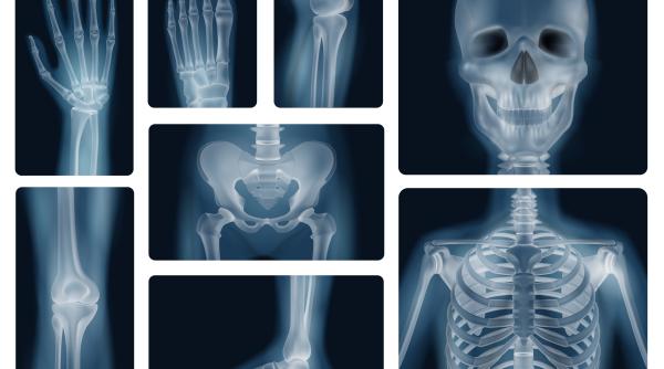 scanare cu raze x in romania senatul a initiat achizitia in valoare de 838 655 lei