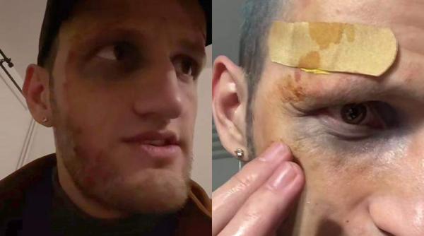 omul cu tourette atacat la metrou de un necunoscut ce s a intamplat de fapt