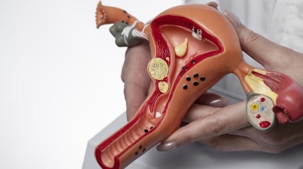 o noua sansa impotriva cancerului de col uterin rafila poate fi prevenit in totalitate