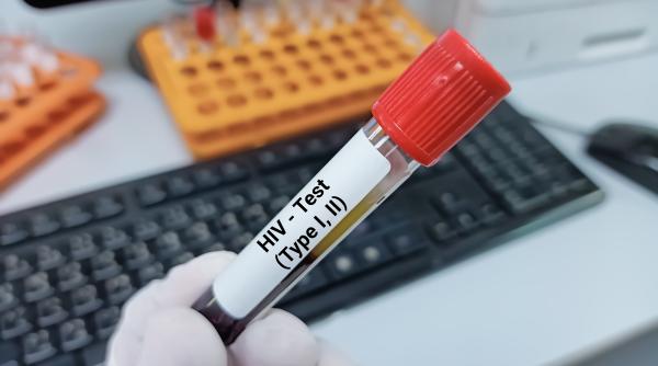 a scazut dramatic testarea hiv ingrijorarea ministrului rafila video