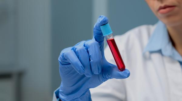 un test de sange ar putea sa revolutioneze diagnosticarea persoanelor suspecte de alzheimer