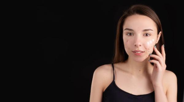 acneea nu se trateaza doar pe piele explicatia din spatele ei thea haimovitz avertizeaza daca incepe intr o zona pregateste te pentru ca migreaza