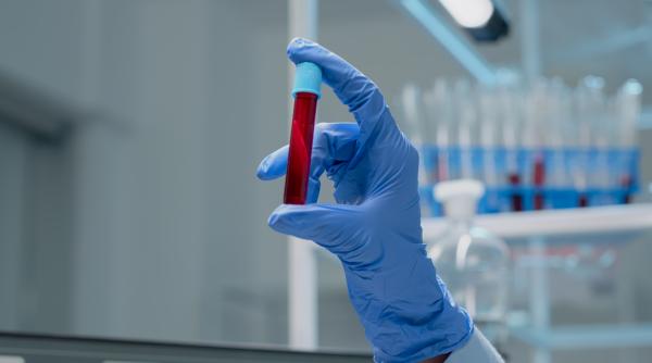 laboratorul de control doping reactie dupa afirmatiile simonei halep privind proba de sange prelevata in bucuresti