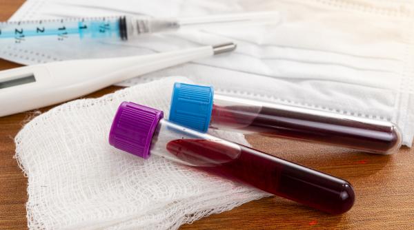 ce se intampla in corpul tau cand ai un nivel crescut al trigliceridelor