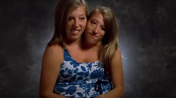 una dintre gemenele siameze abby si brittany hensel s a casatorit cele doua impart acelasi trup de la talie in jos de ce a refuzat mama lor sa le separe la nastere